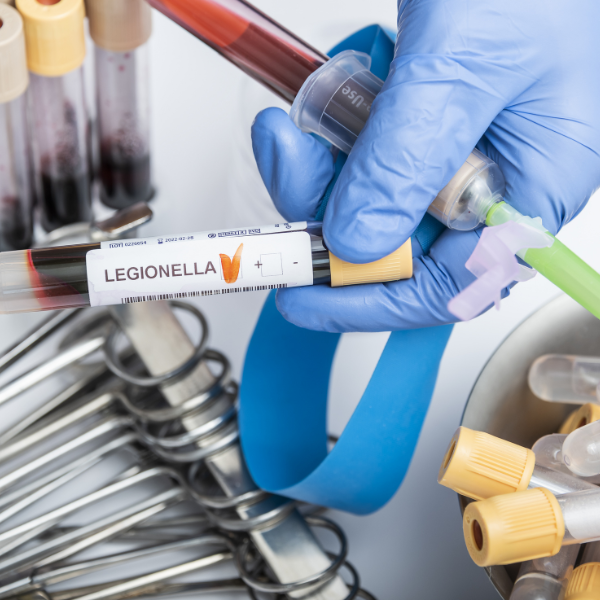 legionella vigo